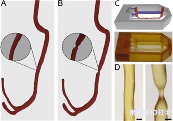 【案例】用通过3D打印模具制做的血管模型研究动脉血栓成因